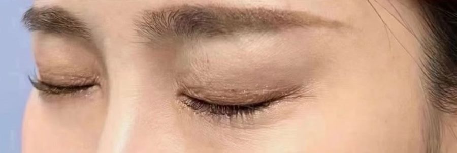 护理后